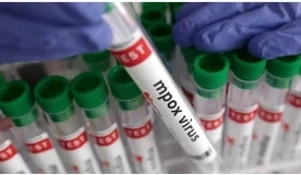 Mpox Case in India: दुनियाभर में बढ़ते मंकीपॉक्स के खतरे के बीच भारत को लेकर भी डराने वाली खबर है। भारत में इसके खतरनाक स्ट्रेन का पहला मामला