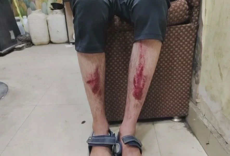 Teacher at St. Michael School in Bhopal assaults student; video evidence submitted to District Education Officer.