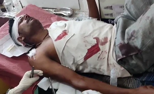 बाघ ने ग्रामीण पर किया हमला