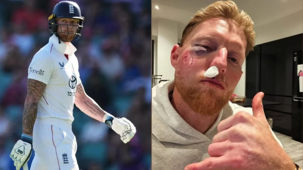 Ben Stokes Injury
