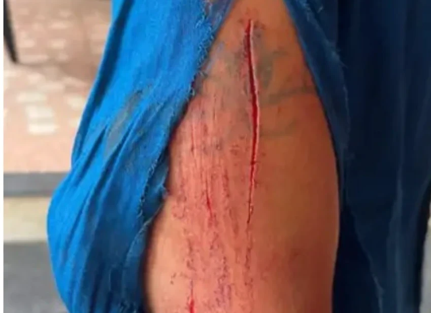 LocalChhattisgarh,Raipur, Raipur Driver Mobile Snatch, Blade Attack