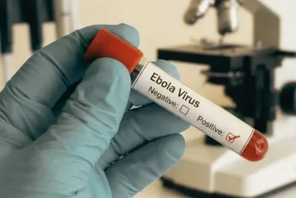 Ebola Virus, Bengaluru News, Ugandan Woman, NIV Pune, WHO Alert, Karnataka Health Department, Ebola Symptoms, African Infection, Epidemic Diseases Hospital, Health Emergency,Ebola Virus Bengaluru News